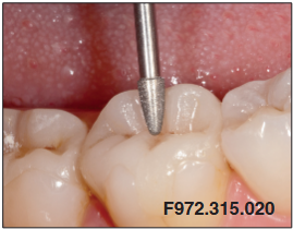 Dijamantna svrdla, granata okrugli 972 - Edenta - Slika 2
