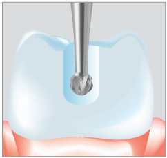 Svrdla od tvrdog metala, okrugla C1S- Edenta - Slika 2
